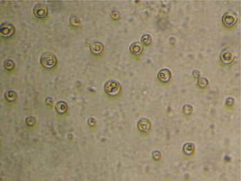 Cryptococcus neoformans | micoclinicaufcspa