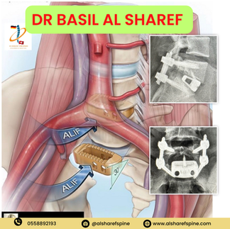 Alt="Complex Spine Surgery"