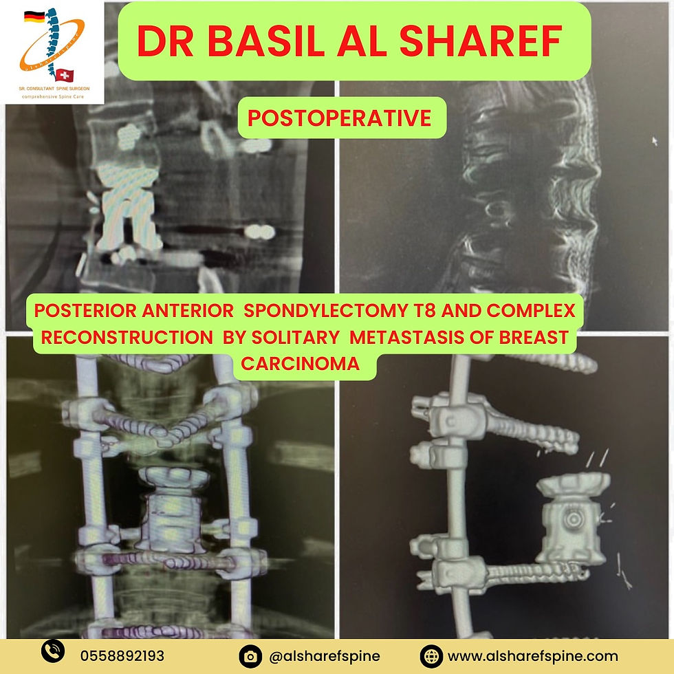 Dr Basil Al Sharef | Pioneer of Complex Spine Surgery | German Spine Surgeon Dubai | German and Swiss Board certified