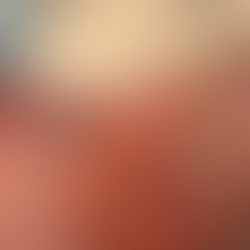 Bebé nació con la T de cobre de su mamá en la mano