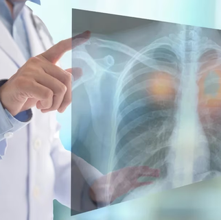 Aumentó la incidencia del cáncer de pulmón en mujeres jóvenes, según un estudio