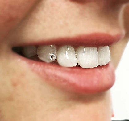smile