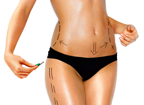 lipolaser_edited.png
