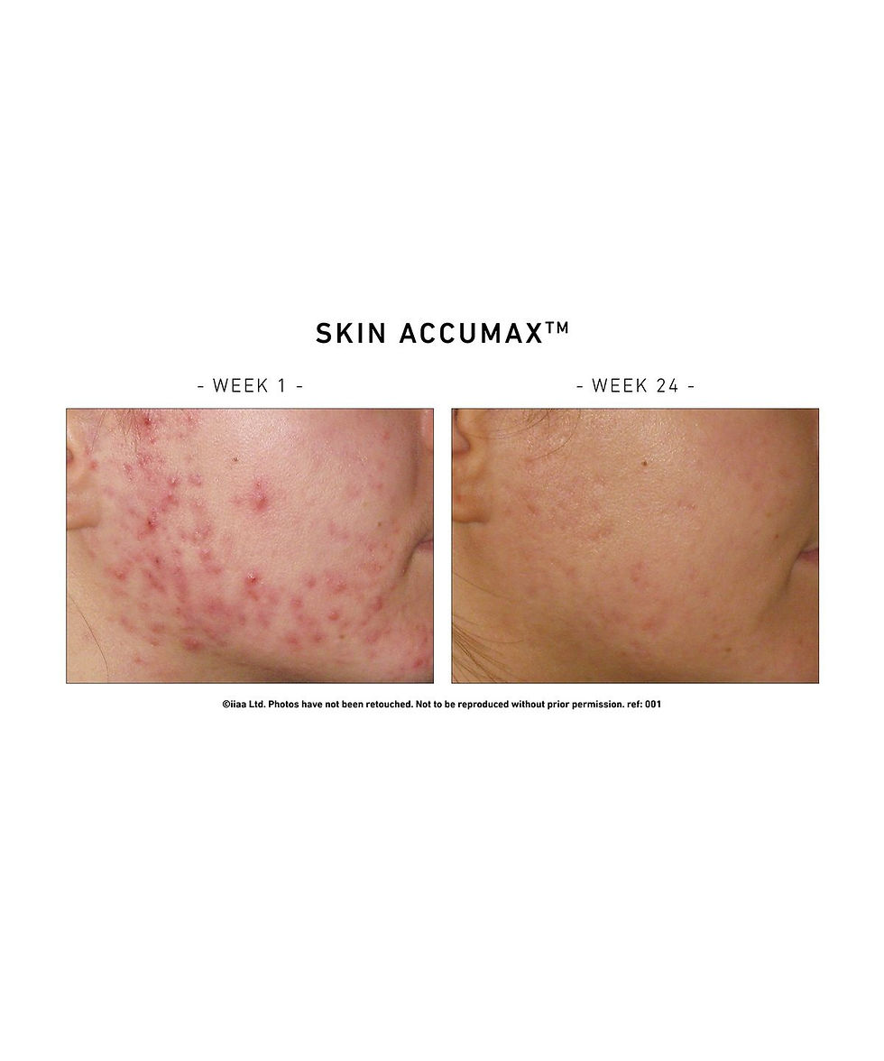 Thumbnail: Skin Accumax 60 Capsules