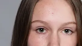 How to Remove Blackheads: Doctor-Approved Tips and Tricks