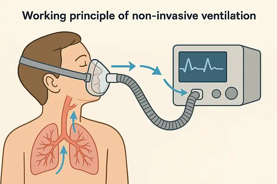 Non-Invasive Ventilation (NIV): What It Is, Types, Benefits & Uses