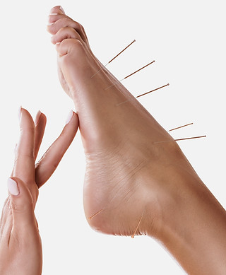 Acupuncture Los Angeles 