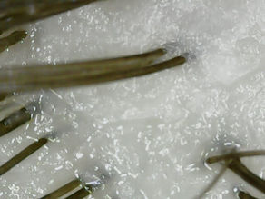 Is Your Scalp Oily or Dry? Identify Your Scalp Type for Improved Hair Health