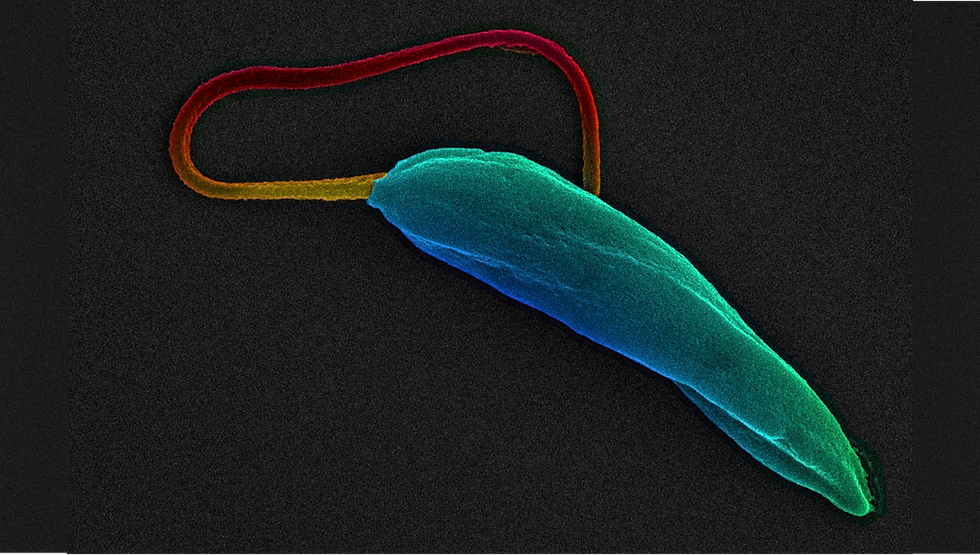 New study identifies immune signals that track visceral Leishmaniasis treatment success