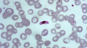 Asexual blood-stage malaria vaccine candidate PfRipr5: enhanced production in insect cells