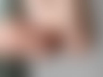 Urticária: o que é e por que não deve ser subestimada