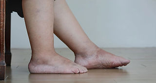 retencao-d_cb4385a962 (1).jpg