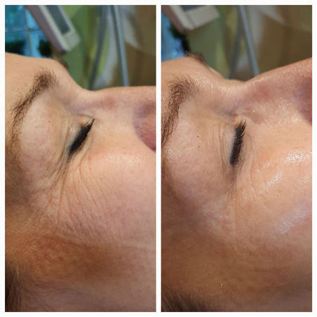 Coolifting Beauty Gun: ronduit indrukwekkend