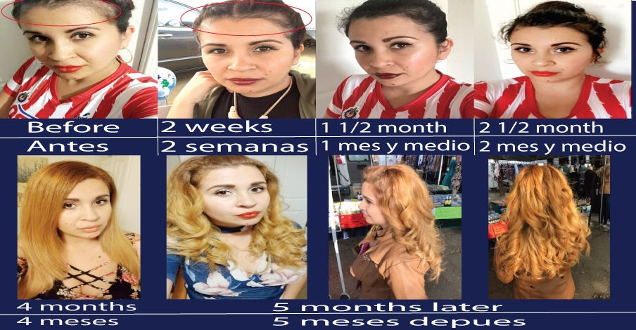 Thumbnail: MORINGA Y GUANABANA