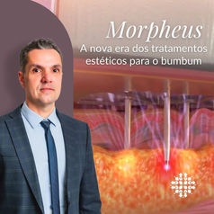 Morpheus: A nova era de tratamentos estéticos para o bumbum