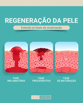 Regeneração da pele: Entenda as fases da cicatrização