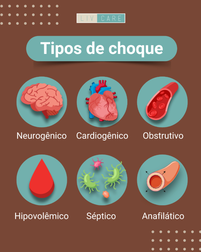 Tipos de choque