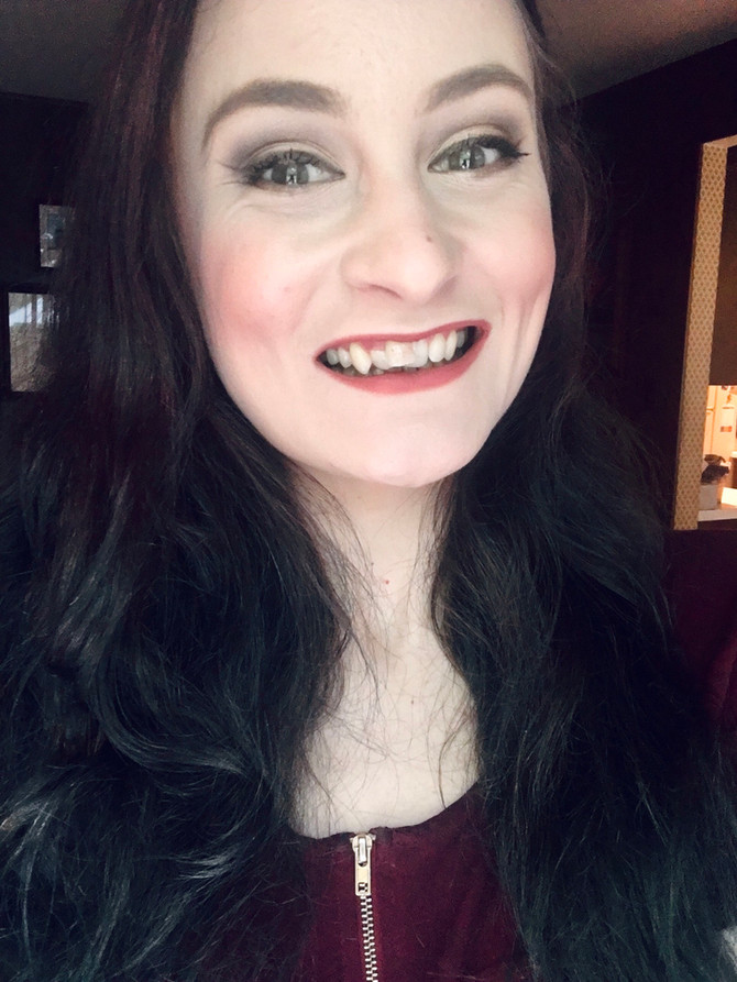 I Am Slowly Learning To Love My Crooked Teeth