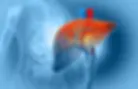 7 Root Causes I See Every Week Driving Fatty Liver