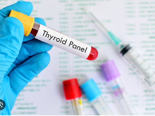 Tired, Sluggish, Over Weight, It Might Be Your ThyroidThyroid Panel