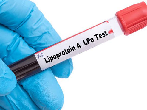 Lipoprotein(a): The Genetic Heart Risk Marker Everyone Should Know