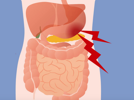 Could Low Stomach Acid Be the Problem?!