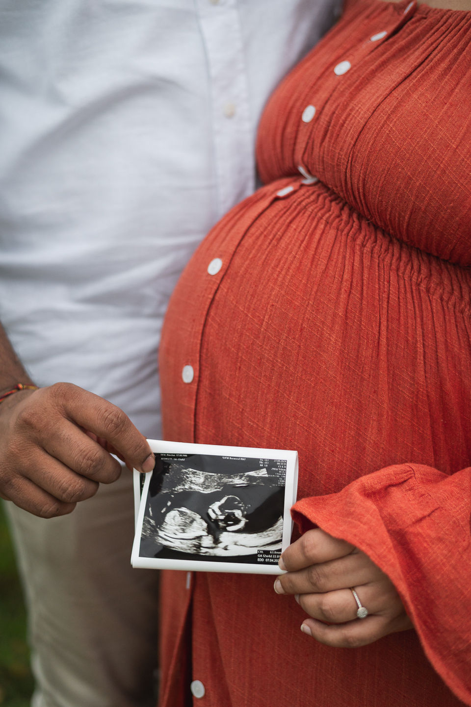 Pregnancy announcement photoshoot with an ultrasound image