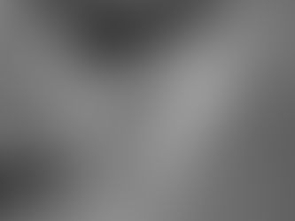 Your Glow-Up Date: What to Expect at Your Perfect Derma Peel Appointment