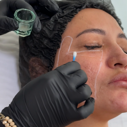 Ver as fotos recentes 2.png