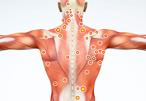 Trigger-Points-CROPPED.jpeg