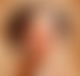 ?איך מזהים כאבי שיניים אצל תינוקות