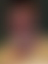 Ana Grynbaum – Vulnerabilidad del rostro 