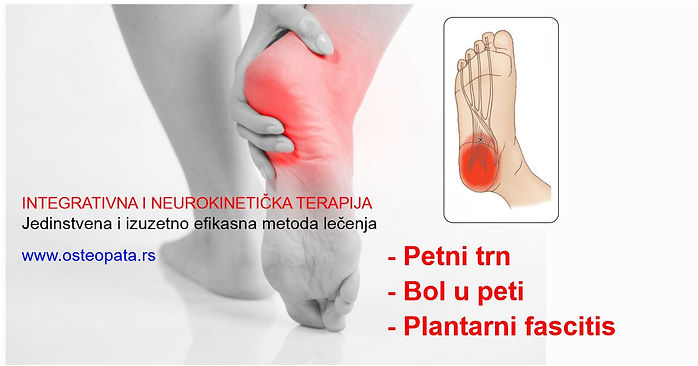 Petni trn, bol u peti, plantarni fasciitis