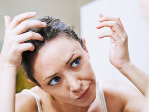 Is a Dry and Itcy Scalp Causing You Problems?