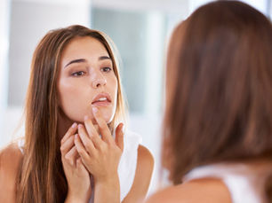 Pimples: can I pop them?!