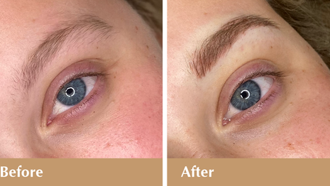 Thinning Eyebrows? Consider Microblading