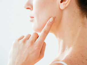 FDA Warns Against At-Home Skin Tag and Mole Removal