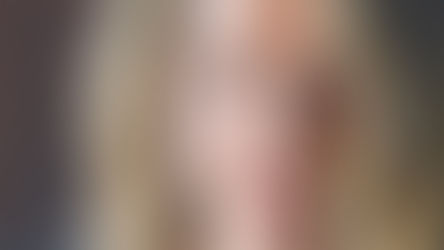 The evolution of Microneedling by Lisa Miller, CNP