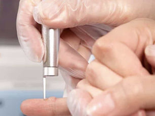 Tom Sawyer and the cure for warts