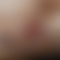 Understanding Big Headed Ants: Habits, Health Risks, and Prevention