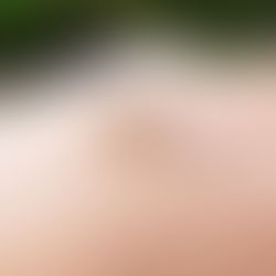 Florida to soon release Genetically Modified Mosquitoes.