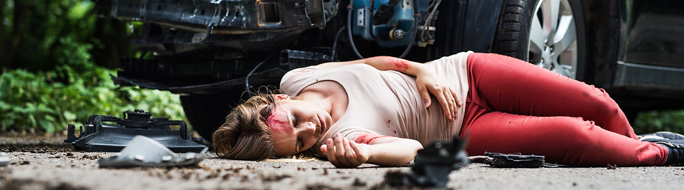 young-injured-woman-lying-on-the-road-af