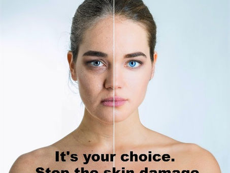 3 quick steps to prevent sun damage