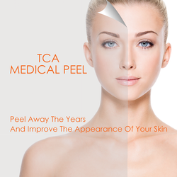 TCA Medical Peel Medical $89.00