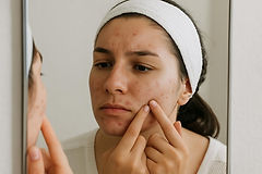 Acne Blemishes: Evidence-Based Treatment & Management Guide