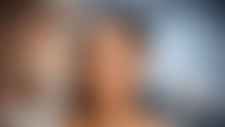 Post-Inflammatory Hyperpigmentation (PIH)