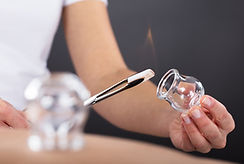 Invigorating Detox Heated Cupping.jpeg
