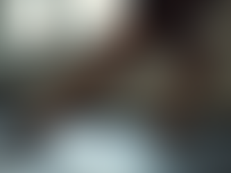 What Causes Soft Tissue Injuries and How to Avoid Them by Dr. Kashyap Solanki