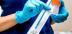 pap smear, colposcopy, cervical cancer screening