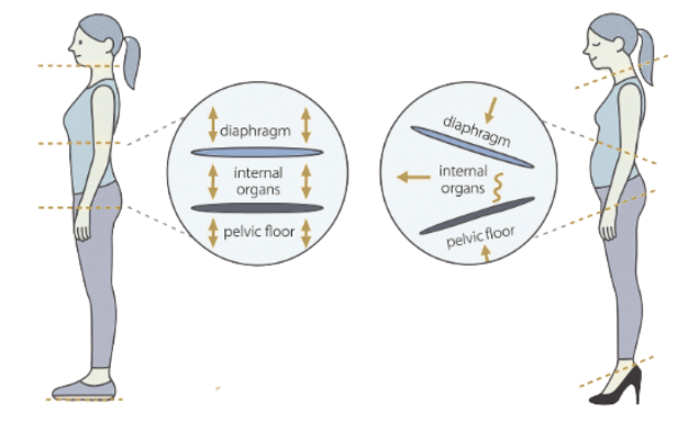 Two women side-by-side; left stands straight, right slouches. Diagrams show diaphragm, organs, pelvic floor.